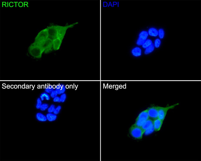 RICTOR Antibody in Immunocytochemistry (ICC/IF)