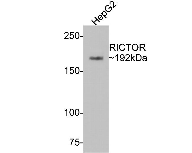 RICTOR Antibody in Western Blot (WB)