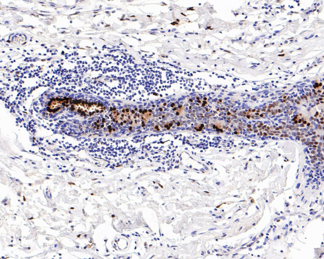 Estrogen Receptor alpha Antibody in Immunohistochemistry (Paraffin) (IHC (P))