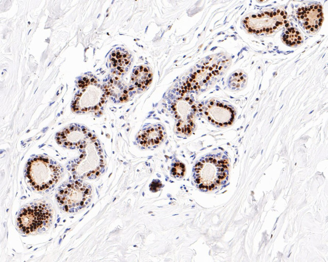 Estrogen Receptor alpha Antibody in Immunohistochemistry (Paraffin) (IHC (P))