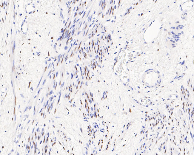 Estrogen Receptor alpha Antibody in Immunohistochemistry (Paraffin) (IHC (P))