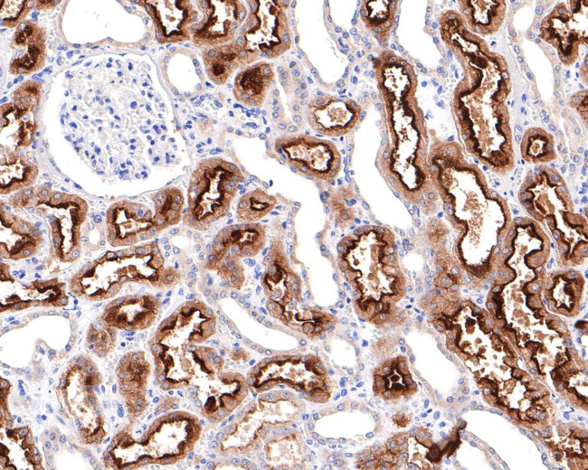 Villin Antibody in Immunohistochemistry (Paraffin) (IHC (P))