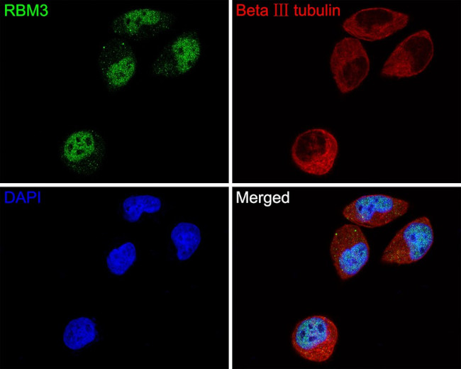 RBM3 Antibody in Immunocytochemistry (ICC/IF)