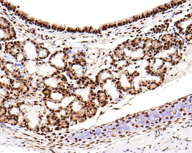 RBM3 Antibody in Immunohistochemistry (Paraffin) (IHC (P))