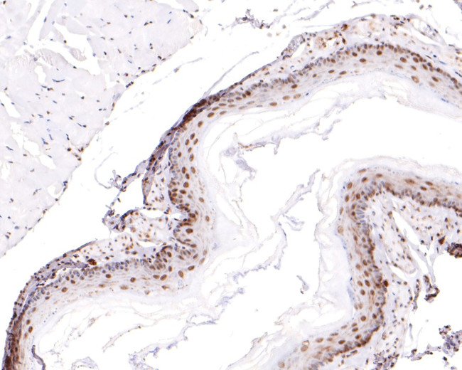 RBM3 Antibody in Immunohistochemistry (Paraffin) (IHC (P))