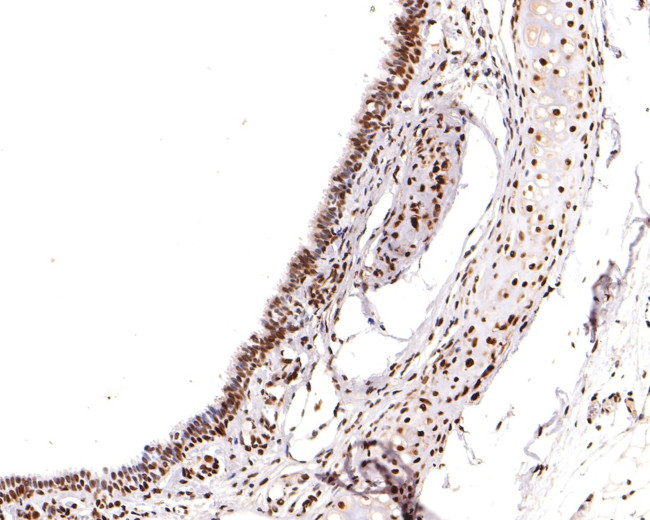 RBM3 Antibody in Immunohistochemistry (Paraffin) (IHC (P))