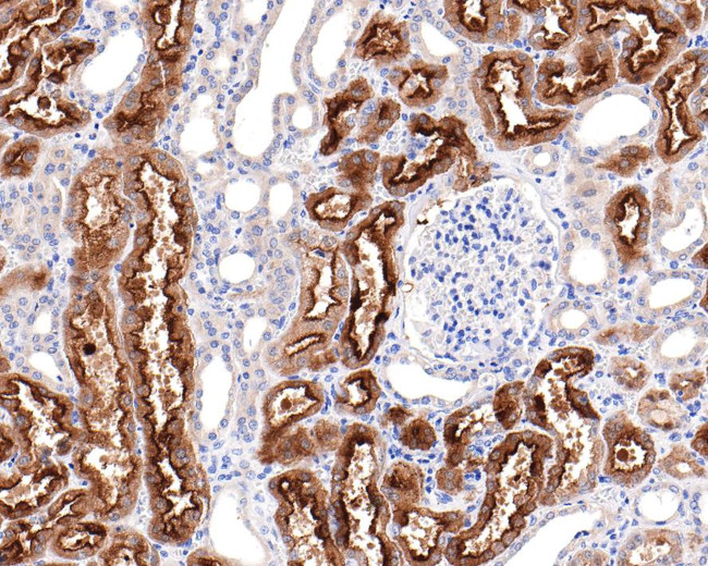 Villin Antibody in Immunohistochemistry (Paraffin) (IHC (P))