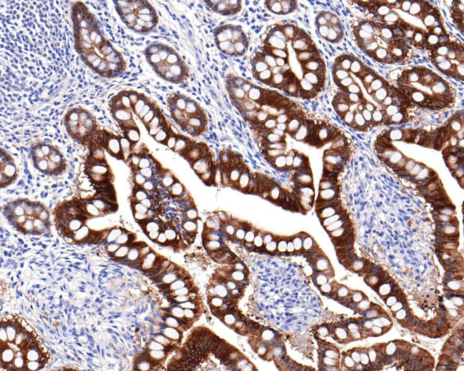 Villin Antibody in Immunohistochemistry (Paraffin) (IHC (P))