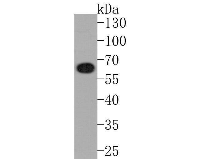 CoA Synthase Antibody in Western Blot (WB)