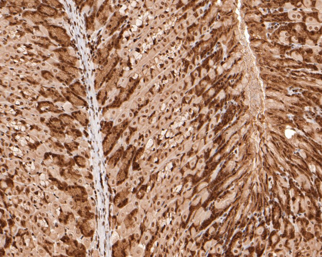 PIN4 Antibody in Immunohistochemistry (Paraffin) (IHC (P))