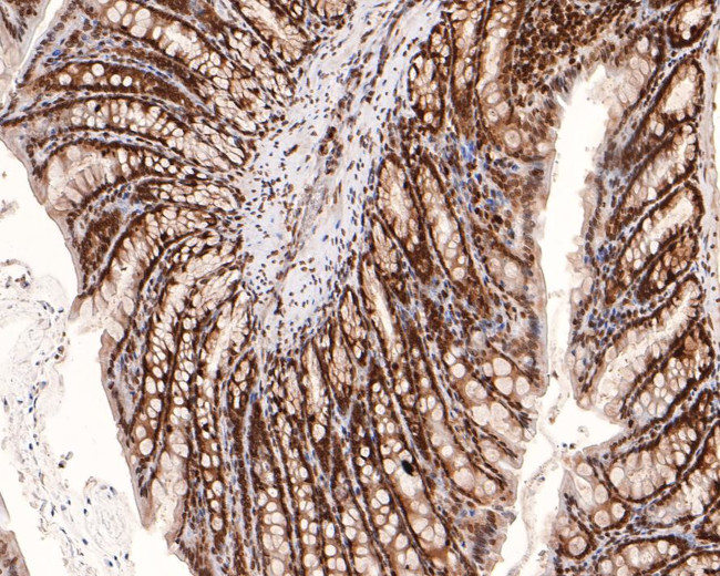 PIN4 Antibody in Immunohistochemistry (Paraffin) (IHC (P))