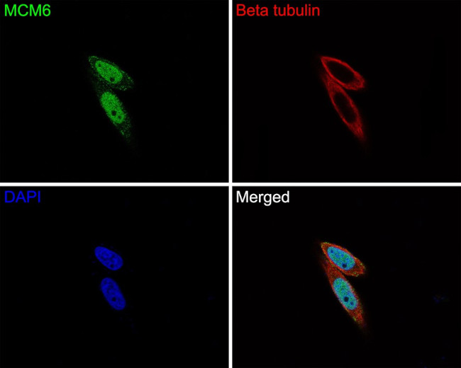 MCM6 Antibody in Immunocytochemistry (ICC/IF)