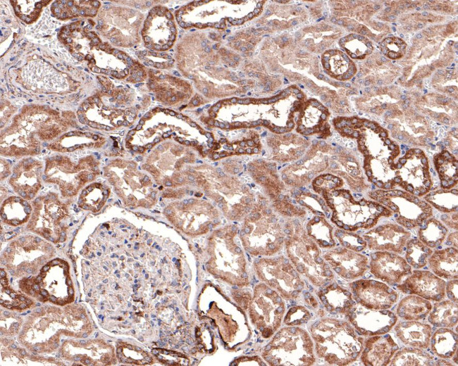 DTYMK Antibody in Immunohistochemistry (Paraffin) (IHC (P))