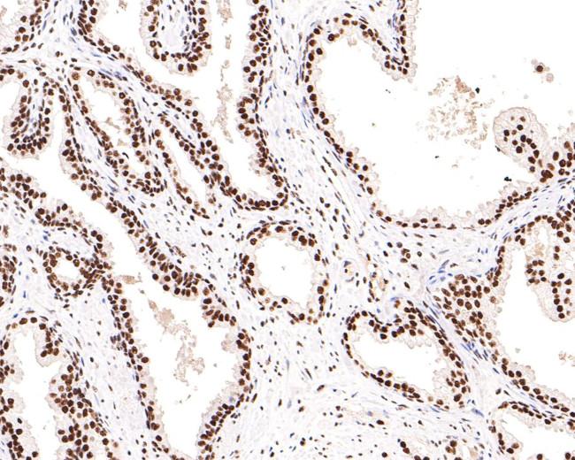 SF3A3 Antibody in Immunohistochemistry (Paraffin) (IHC (P))