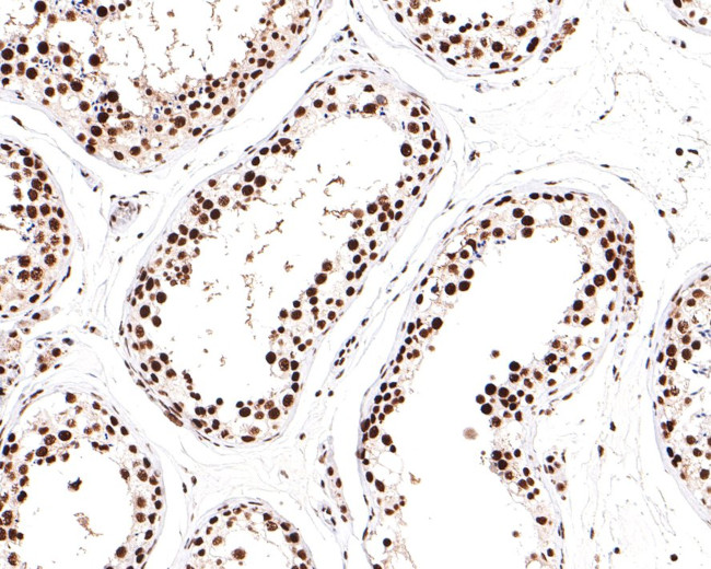 SF3A3 Antibody in Immunohistochemistry (Paraffin) (IHC (P))