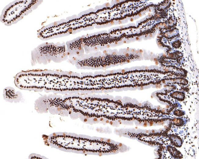 SF3A3 Antibody in Immunohistochemistry (Paraffin) (IHC (P))