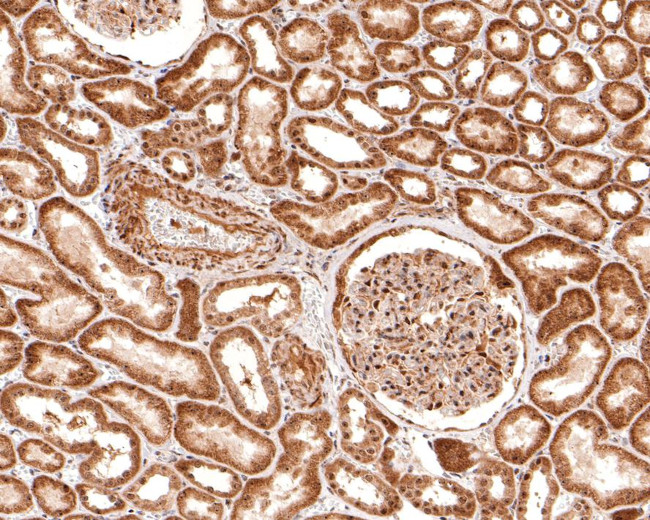 NOLC1 Antibody in Immunohistochemistry (Paraffin) (IHC (P))