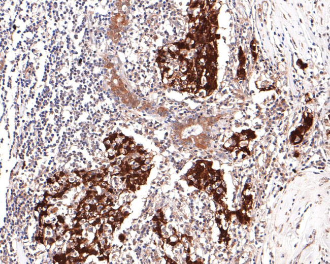 UFC1 Antibody in Immunohistochemistry (Paraffin) (IHC (P))