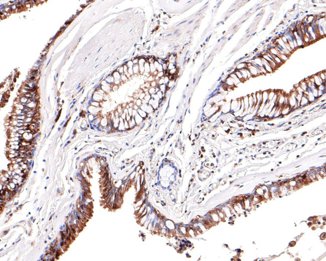 UFC1 Antibody in Immunohistochemistry (Paraffin) (IHC (P))