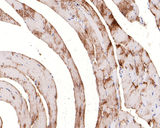 PGM1 Antibody in Immunohistochemistry (Paraffin) (IHC (P))