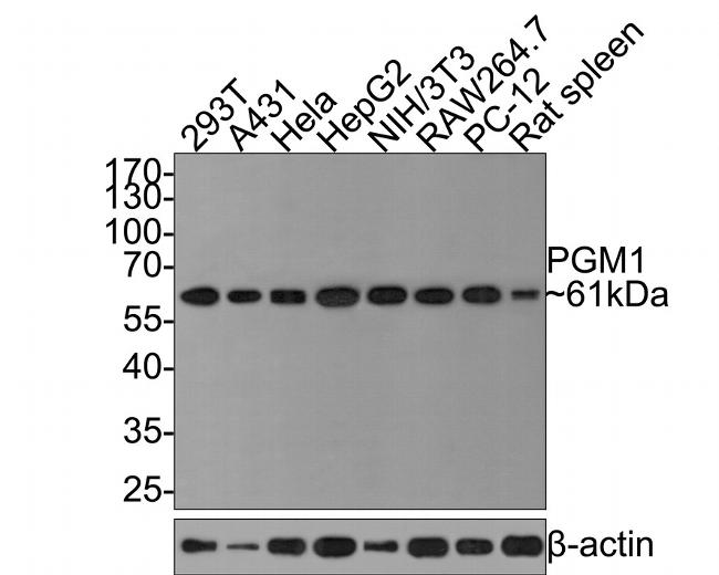 PGM1 Antibody in Western Blot (WB)