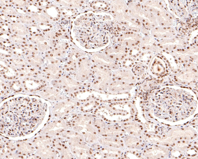 NTHL1 Antibody in Immunohistochemistry (Paraffin) (IHC (P))