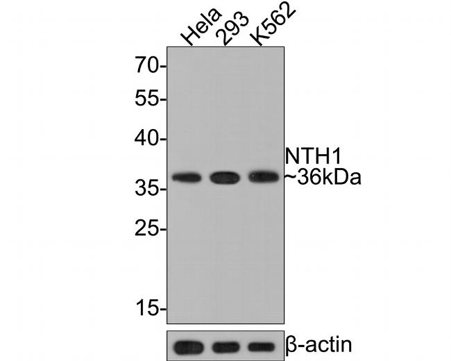 NTHL1 Antibody in Western Blot (WB)