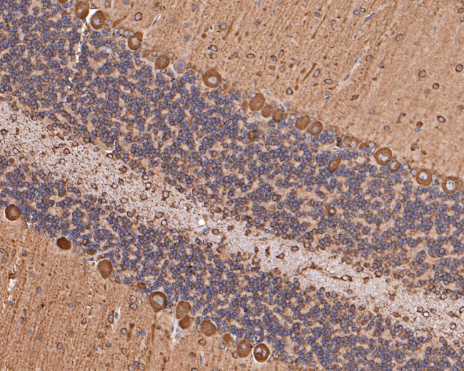 RPS8 Antibody in Immunohistochemistry (Paraffin) (IHC (P))