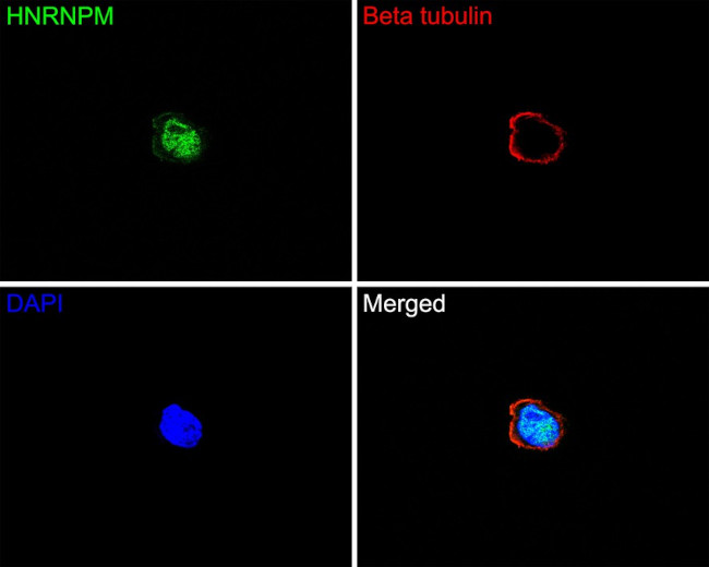 hnRNP M Antibody in Immunocytochemistry (ICC/IF)