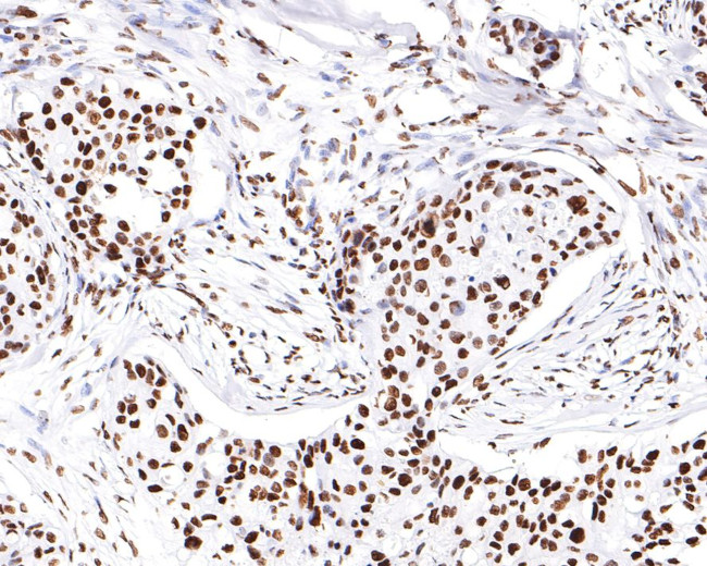 hnRNP M Antibody in Immunohistochemistry (Paraffin) (IHC (P))