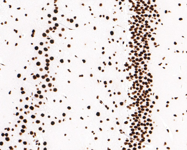 hnRNP M Antibody in Immunohistochemistry (Paraffin) (IHC (P))