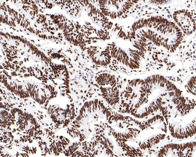 hnRNP M Antibody in Immunohistochemistry (Paraffin) (IHC (P))