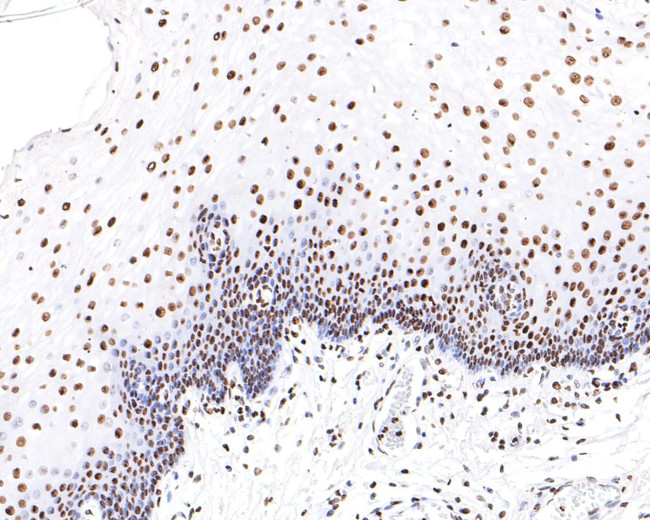 hnRNP M Antibody in Immunohistochemistry (Paraffin) (IHC (P))