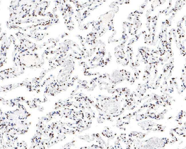 hnRNP M Antibody in Immunohistochemistry (Paraffin) (IHC (P))