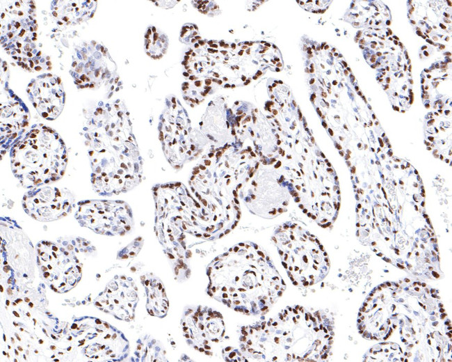 hnRNP M Antibody in Immunohistochemistry (Paraffin) (IHC (P))