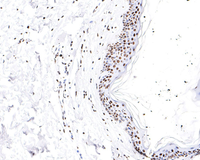 hnRNP M Antibody in Immunohistochemistry (Paraffin) (IHC (P))