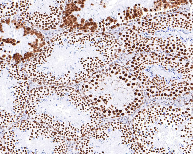 hnRNP M Antibody in Immunohistochemistry (Paraffin) (IHC (P))