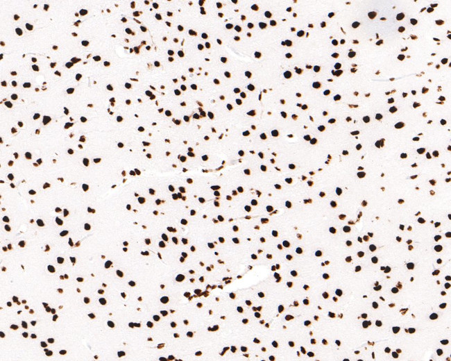 hnRNP M Antibody in Immunohistochemistry (Paraffin) (IHC (P))