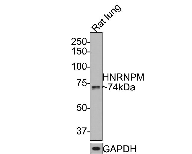 hnRNP M Antibody in Western Blot (WB)