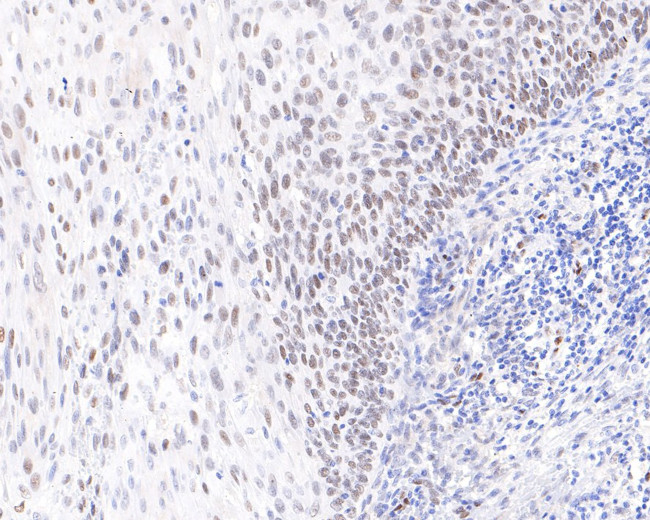 RAVER2 Antibody in Immunohistochemistry (Paraffin) (IHC (P))