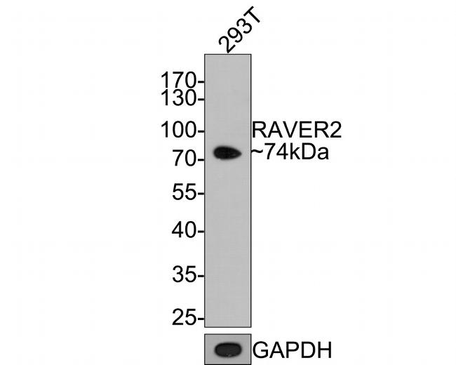 RAVER2 Antibody in Western Blot (WB)