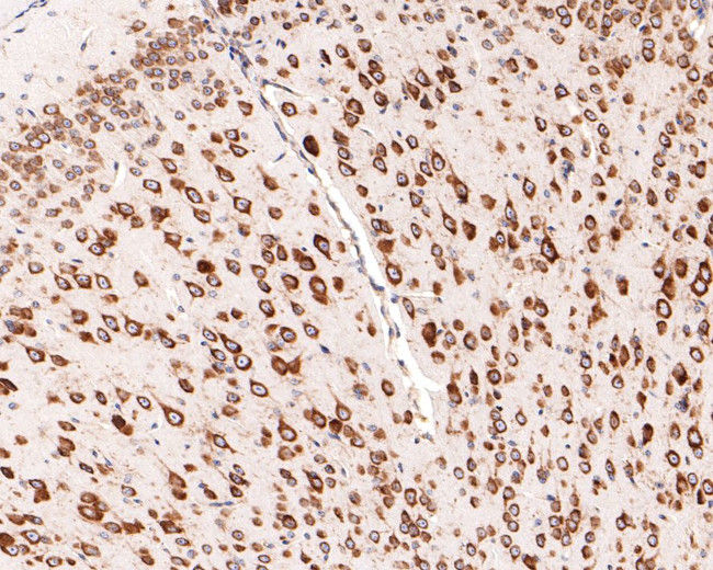 RPL10A Antibody in Immunohistochemistry (Paraffin) (IHC (P))