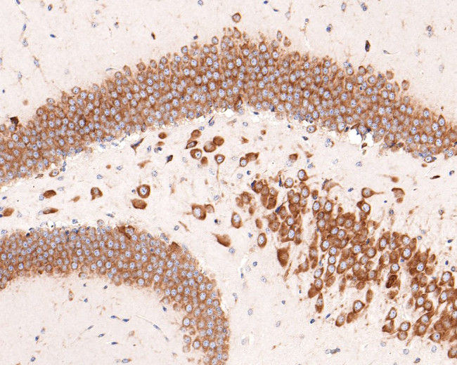 RPL10A Antibody in Immunohistochemistry (Paraffin) (IHC (P))