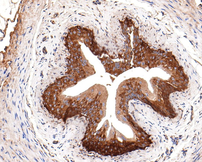 RPL10A Antibody in Immunohistochemistry (Paraffin) (IHC (P))