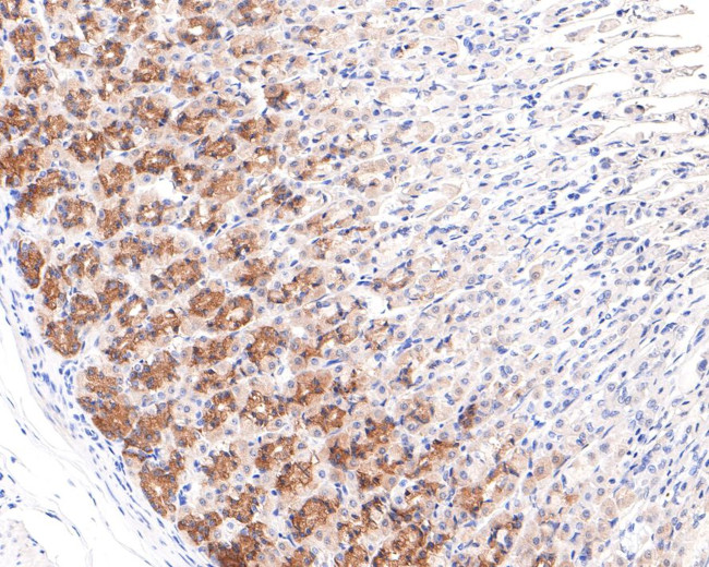 RPL10A Antibody in Immunohistochemistry (Paraffin) (IHC (P))