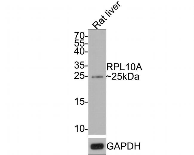 RPL10A Antibody in Western Blot (WB)