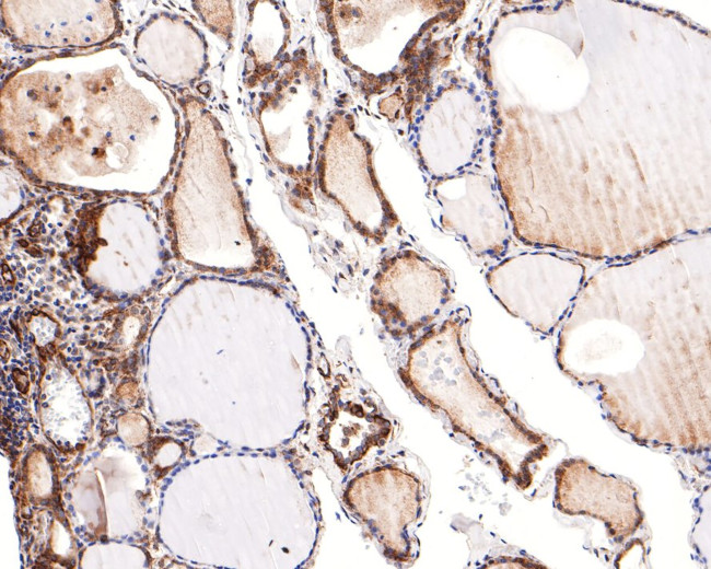 RASEF Antibody in Immunohistochemistry (Paraffin) (IHC (P))