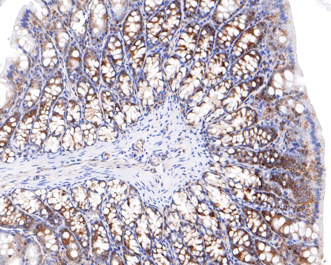 RASEF Antibody in Immunohistochemistry (Paraffin) (IHC (P))