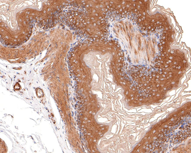 CYFIP1 Antibody in Immunohistochemistry (Paraffin) (IHC (P))