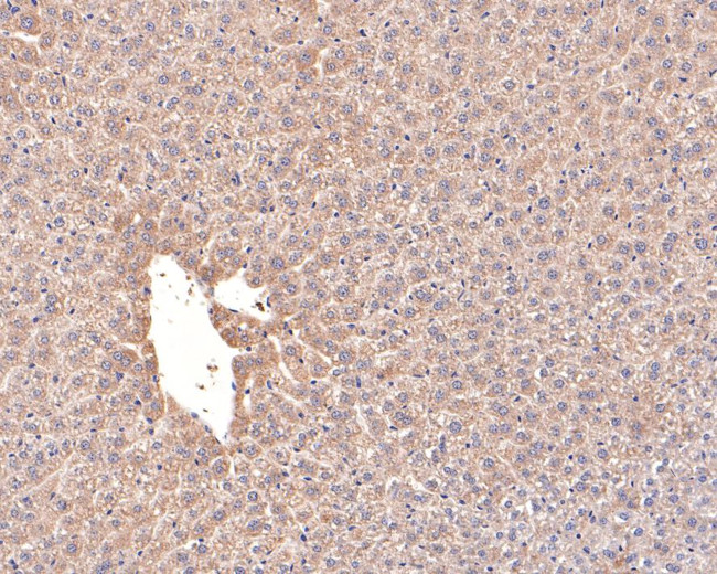 ACAT1 Antibody in Immunohistochemistry (Paraffin) (IHC (P))